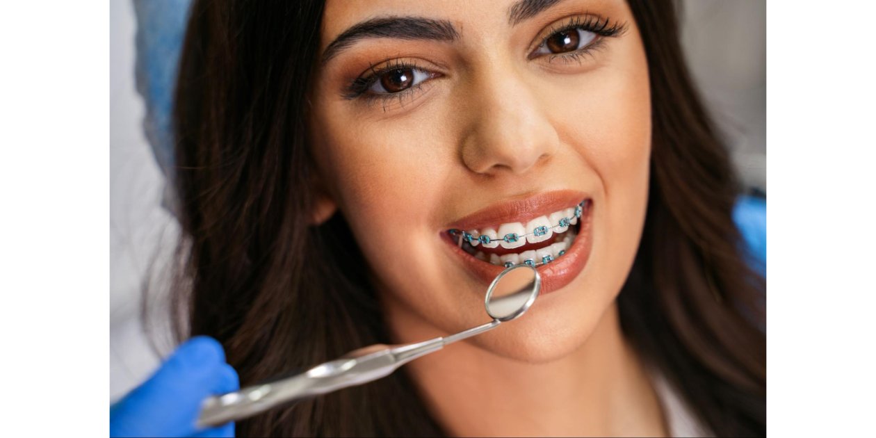 What Types of Bite Issues Can Braces Fix?