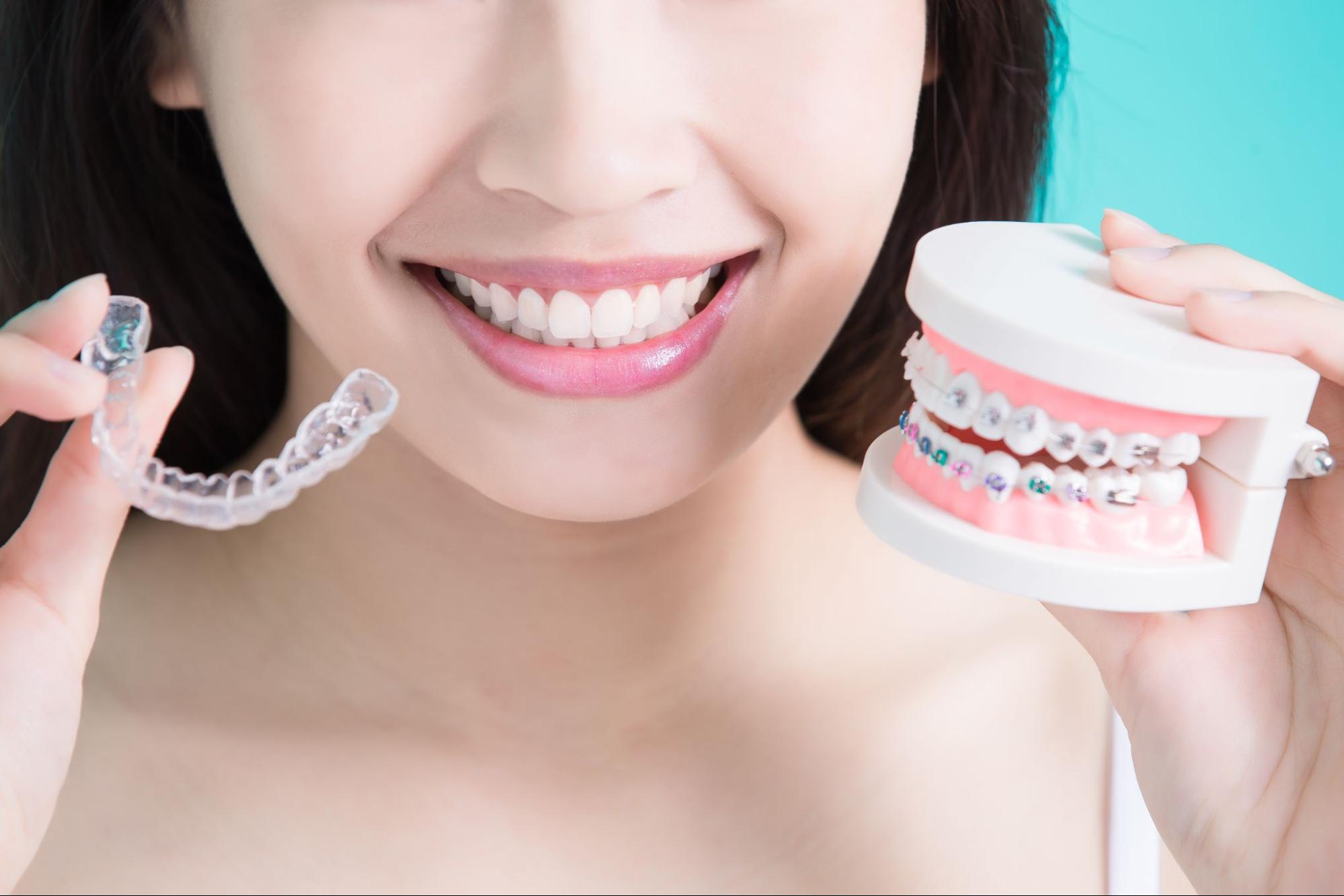 How to Choose Between Braces and Clear Aligners?